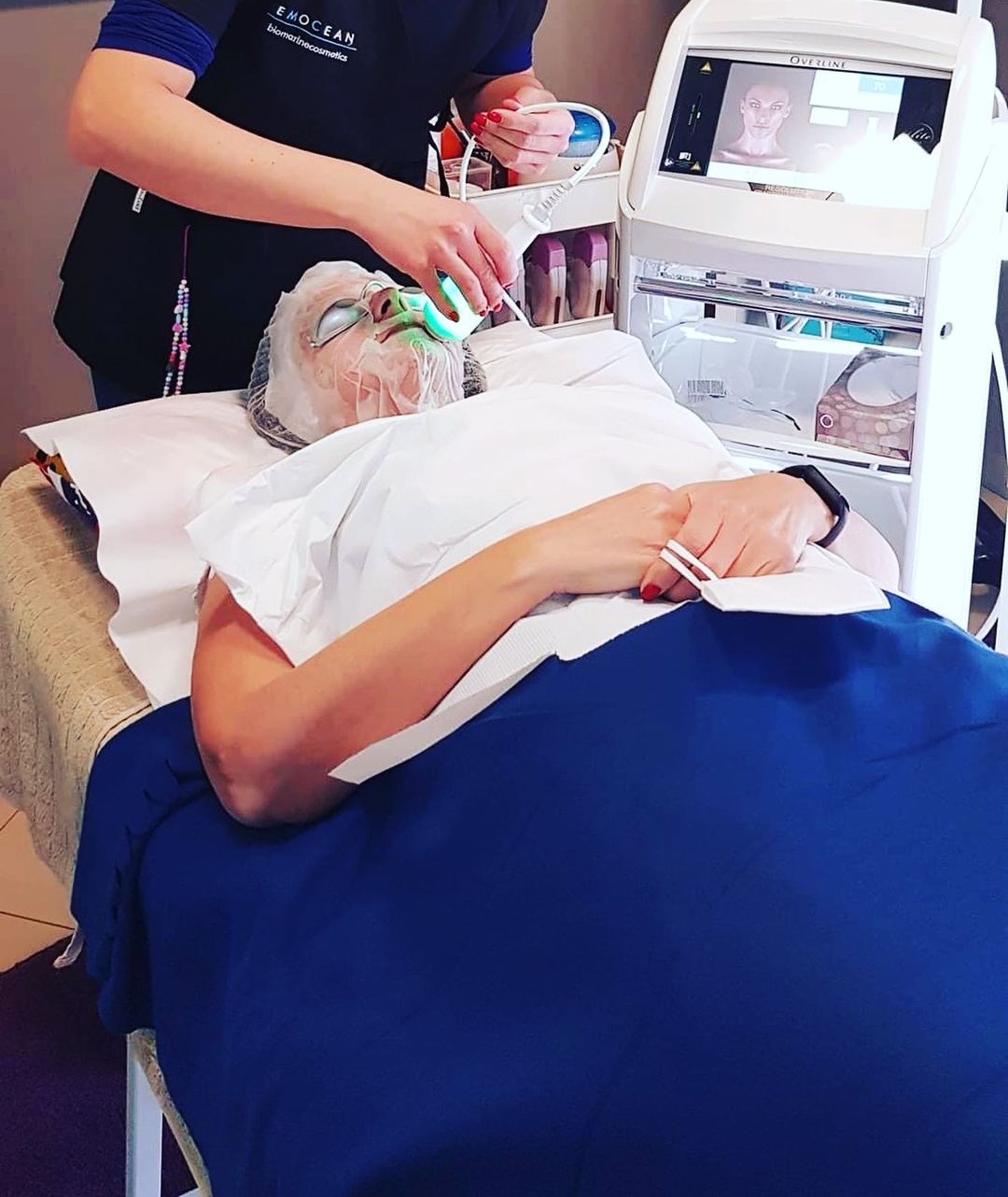 Radiofrequenza viso e corpo Esteica Il Girasole Beauty Center San Giovanni La Punta
